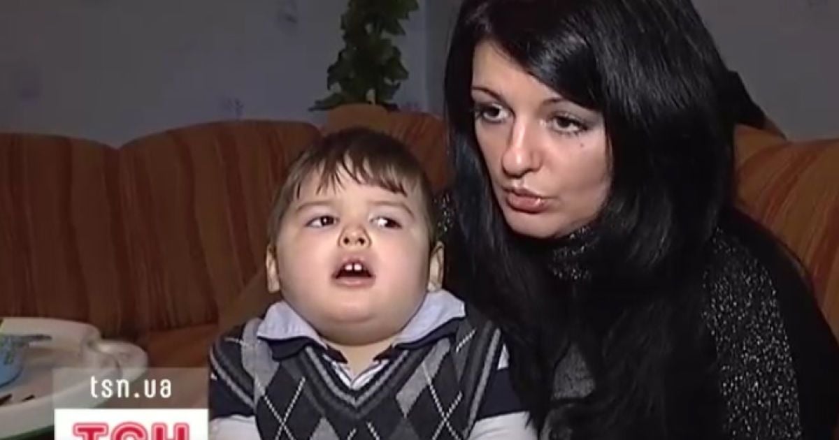 Хлопчик через загадкову хворобу зупинився в розвитку