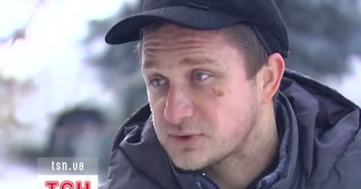 Киянин обварився окропом у столичному спортклубі
