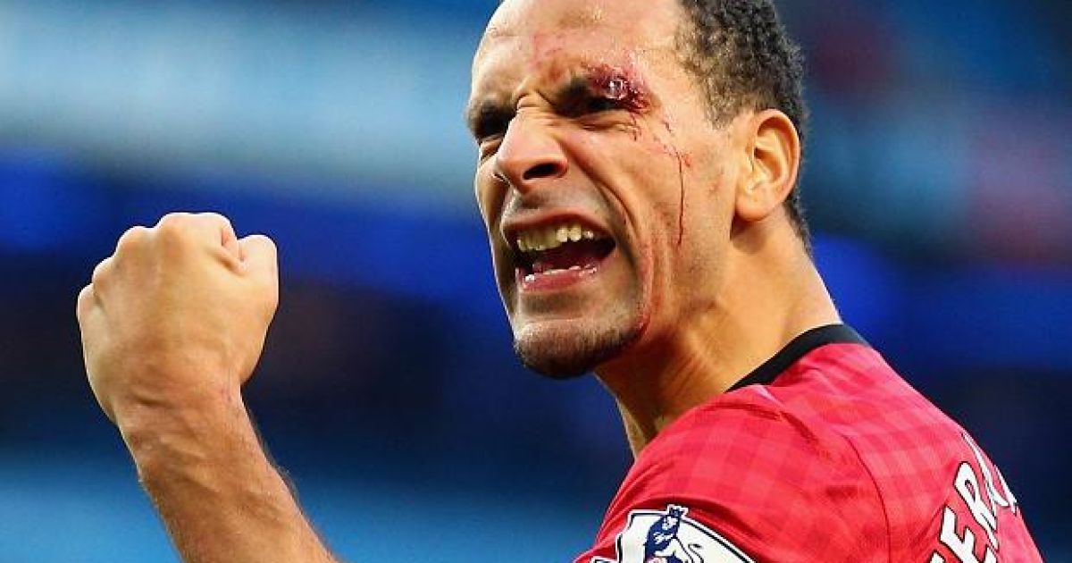 Фердінанда травмували монеткою