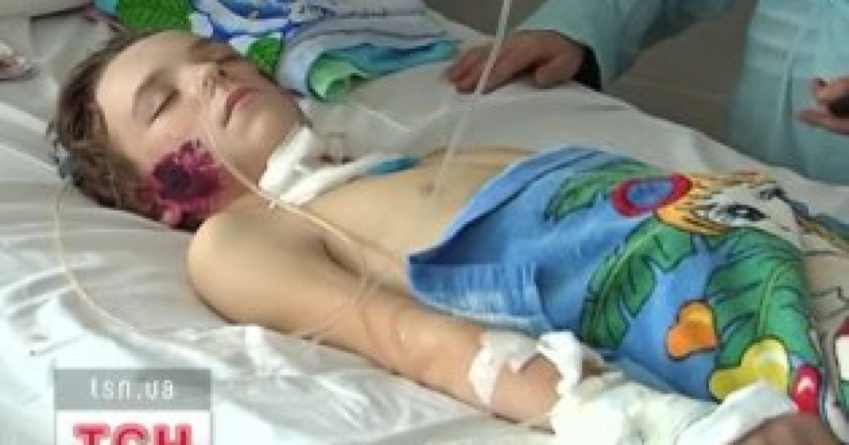 15-річний Віталій вже місяць лежить у комі