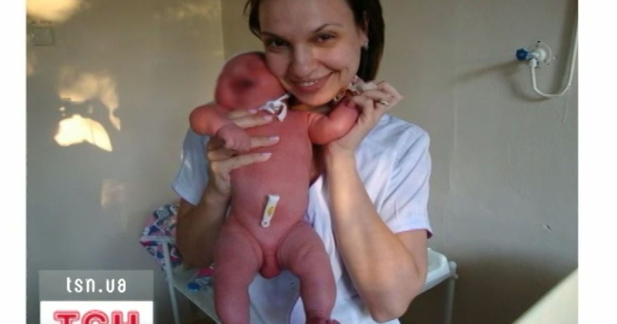 Медсестри виклали фотографії у соцмережу