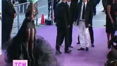 Леді Гага перенесла операцію на нозі