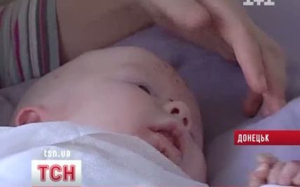 Украинские врачи подарили жизнь рожденному без кожи ребенку