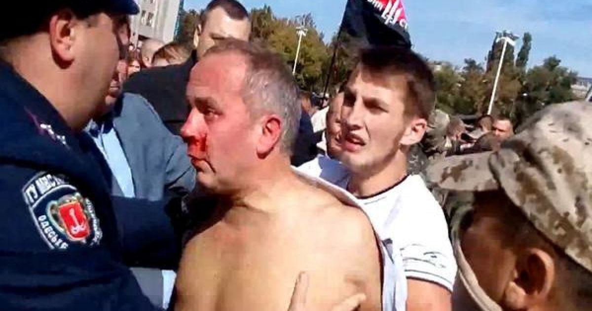 Закривавленого нардепа відвезли до приватної клініки