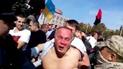 Шуфричу розбили губу і ніс
