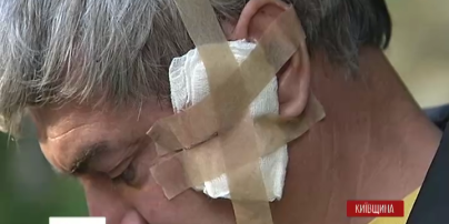 Збори «Спілки рибалок» на Київщині закінчилися стріляниною
