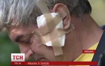 На Киевщине во время собрания рыбаков подстрелили журналиста