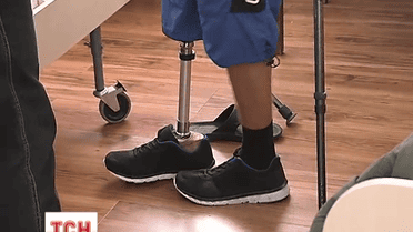 Поранених в АТО бійців почали протезувати державним коштом