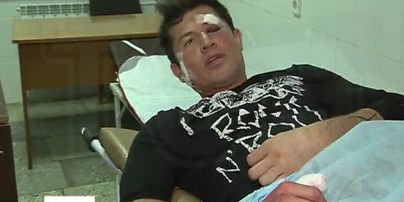 Джеджула показал тяжелые ушибы и рассказал кого подозревает в нападении