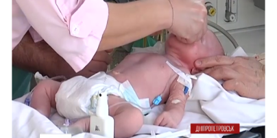 В Днепропетровске появилось уникальное медицинское оборудование для лечения младенцев