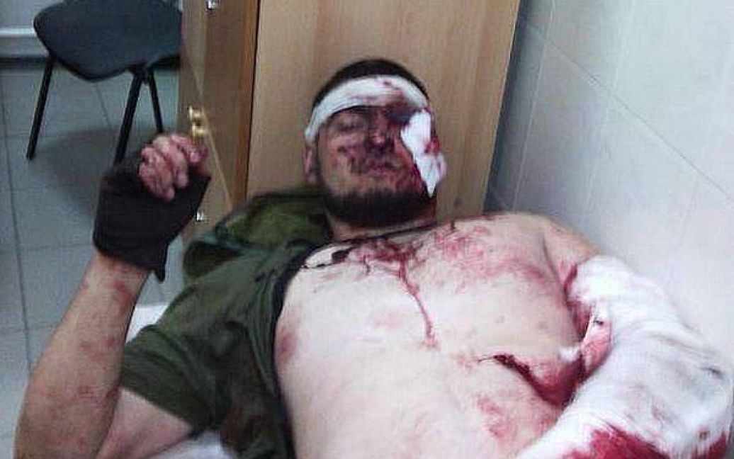 Раненный в Донецке чеченский боевик / © argumentua.com