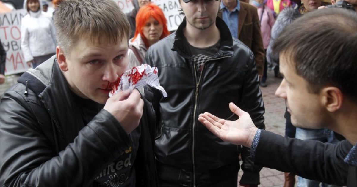 Між прихильниками і противниками демонтажу МАФів сталася бійка