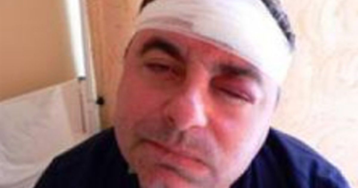 Суд визнав Шевчука винним у побитті журналіста Дементія Білого