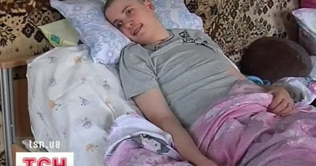 Анатолію довелося видалити майже всю праву половину мозоку