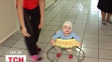 На Хмельниччині хлопчик обпік частину голови