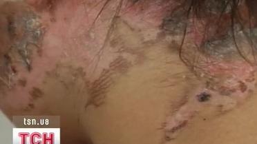 Звіряче катування на Сумщині