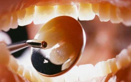 Ученые разработали способ, как лечить зубы и не сверлить их