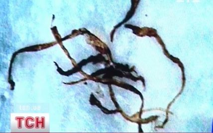 Загадкова хвороба "скаженого черв'яка" швидко поширюється Україною