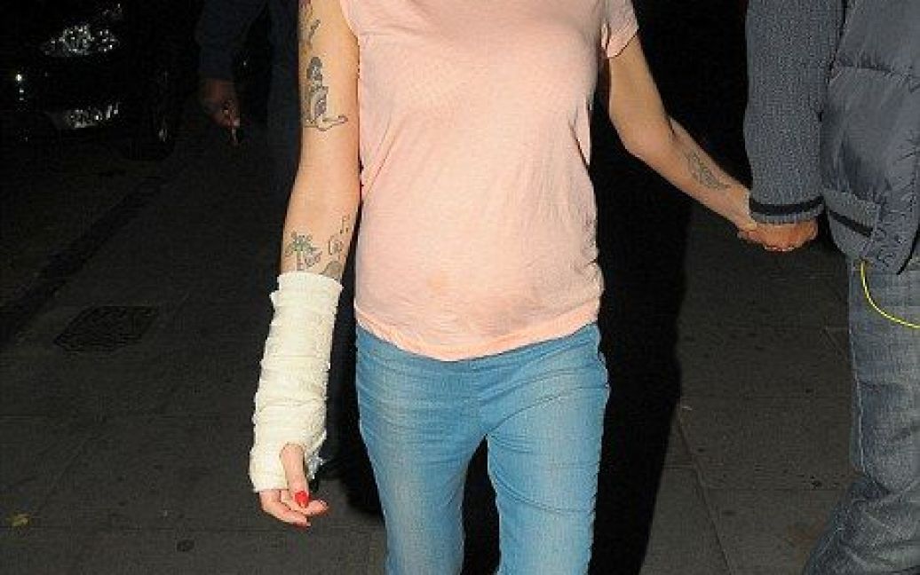 Емі Вайнхаус зламала руку / © Daily Mail