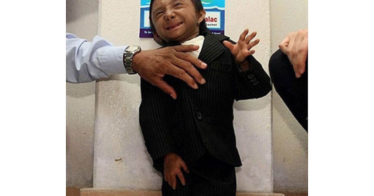 Мініатюрний непалець на цілу голову нижчий за попереднього власника рекорду китайця Хе Пінпіна із зростом 73 см / © AFP