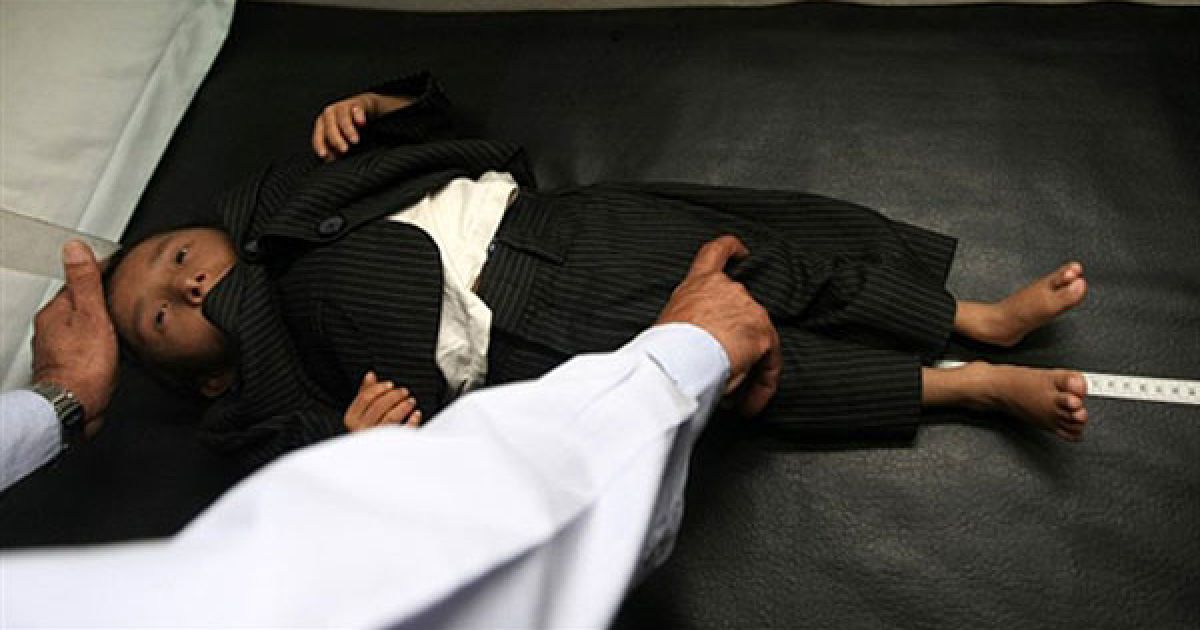 Зріст і вагу Хагендри перевірили у положенні лежачи і стоячи / © AFP