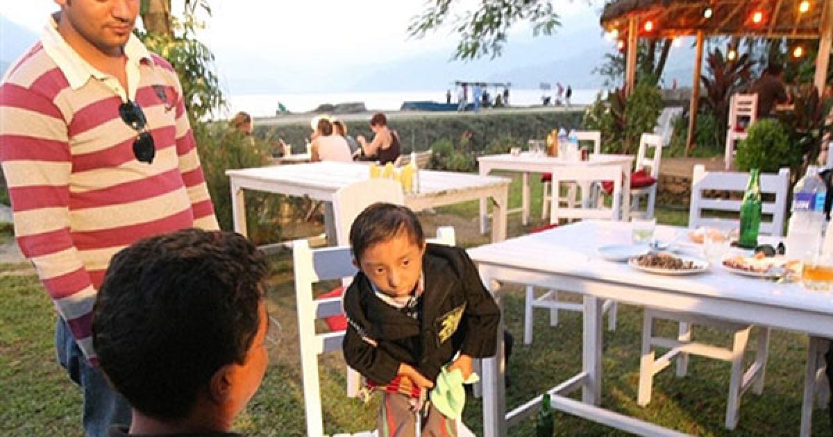 Передбачається, що причиною цього стала зародкова карликовість. / © AFP