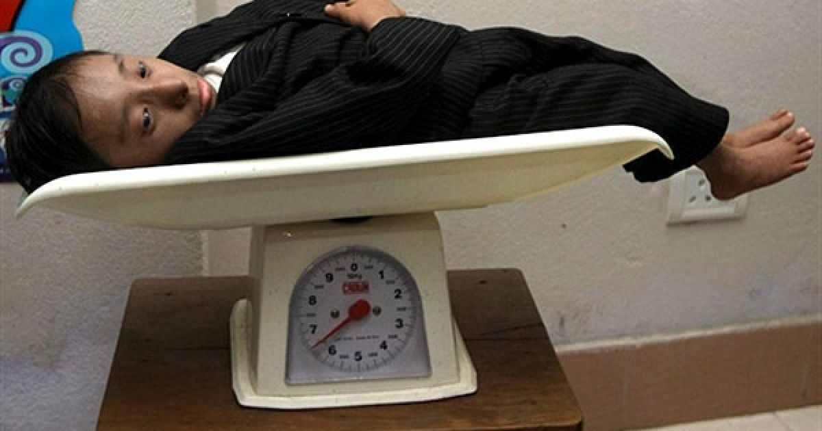 Вага 18-річного Хагендри становить 5,5 кг. / © AFP