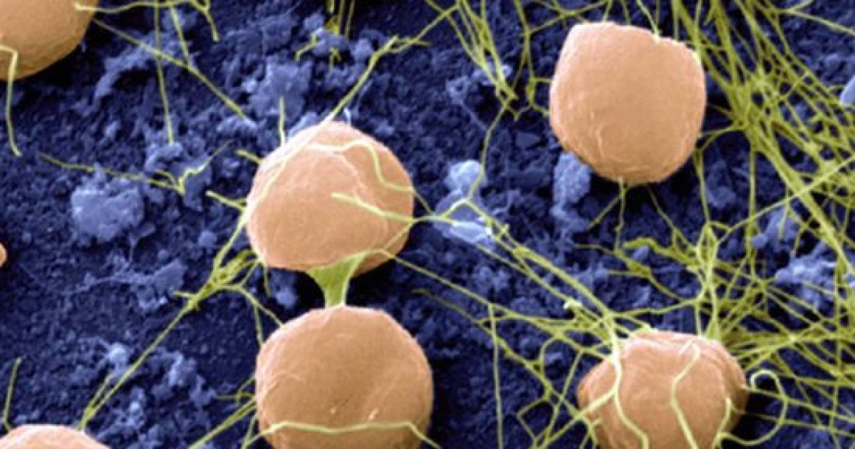 Иллюстрация. Анализ облака микробов теоретически способен определить, где побывал подозреваемый