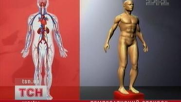 Температурный скачок