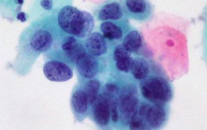 Вчені винайшли дешевий кольоровий тест для діагностики ВІЛ та раку