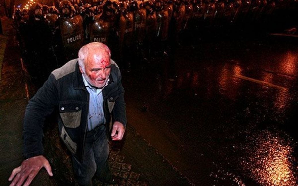 Грузія, Тбілісі. Поранена людина проходить перед грузинської поліцією, яка жорстко розігнала мітинг опозиції перед парламентом у Тбілісі. ОМОН застосував сльозогінний газ, гумові кулі та палиці для розгону акції опозиціонерів, які вимагали відставки президента Михайла Саакашвілі. / © AFP