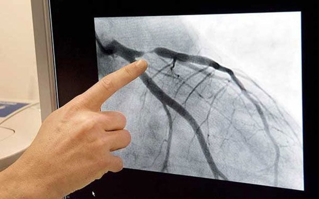 Ірландець зняв на фотокамеру операцію на власному серці, відмовившися від загального наркозу. / © swns.com