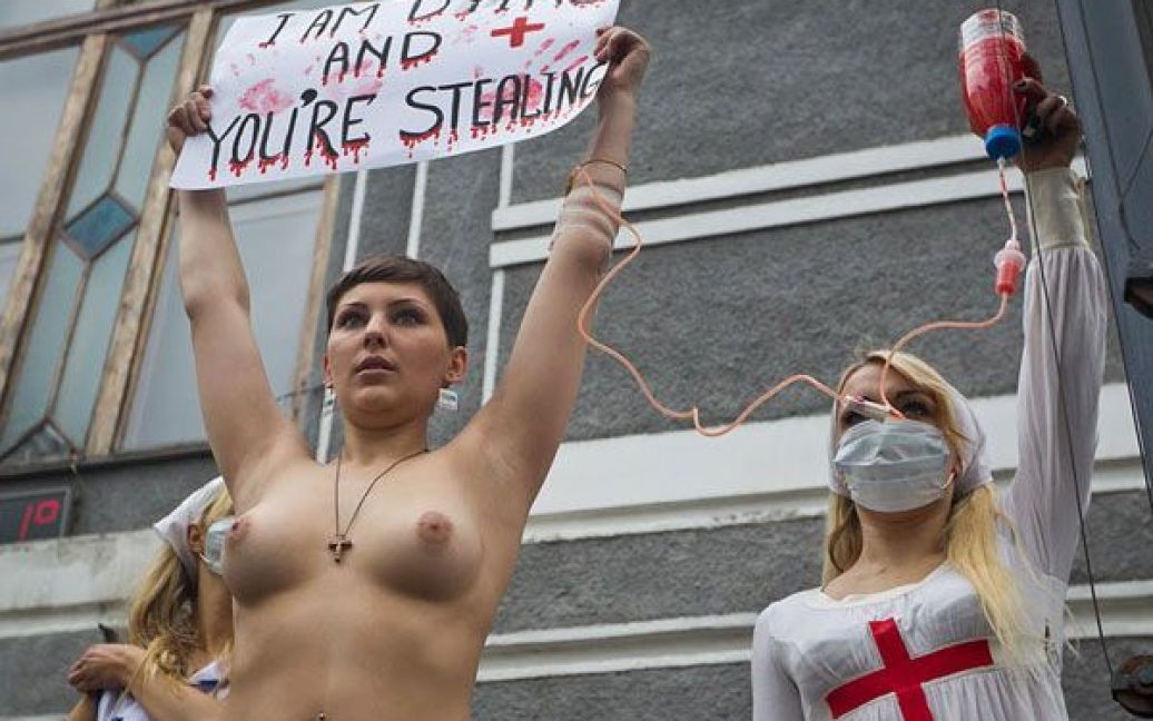 Активістка руху Аліна Ковальчук, яка страждає на рак лімфовузлів другої стадії протестувала топлес / © Жіночий рух FEMEN