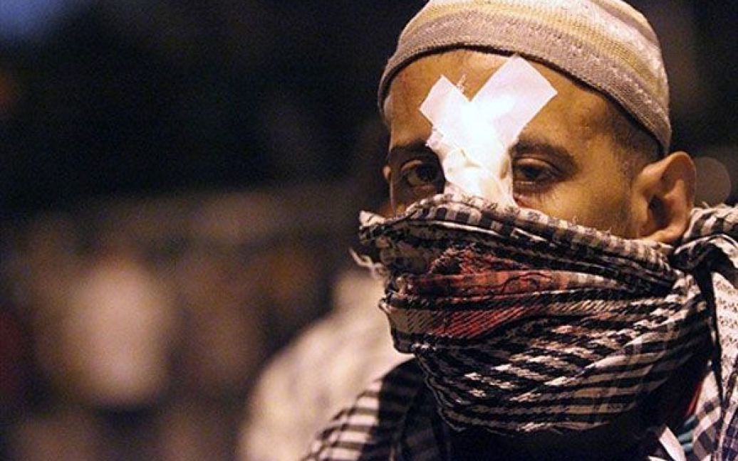 Єгипет, Каїр. Учасник акції протесту отримав поранення під час зіткнень з поліцією перед посольством Ізраїлю в Каїрі. Єгиптяни вимагали висилки посла Ізраїлю з країни. Поліція розігнала демонстрантів сльозогінним газом. Принаймні, 24 особи отримали поранення в ході зіткнень. / © AFP