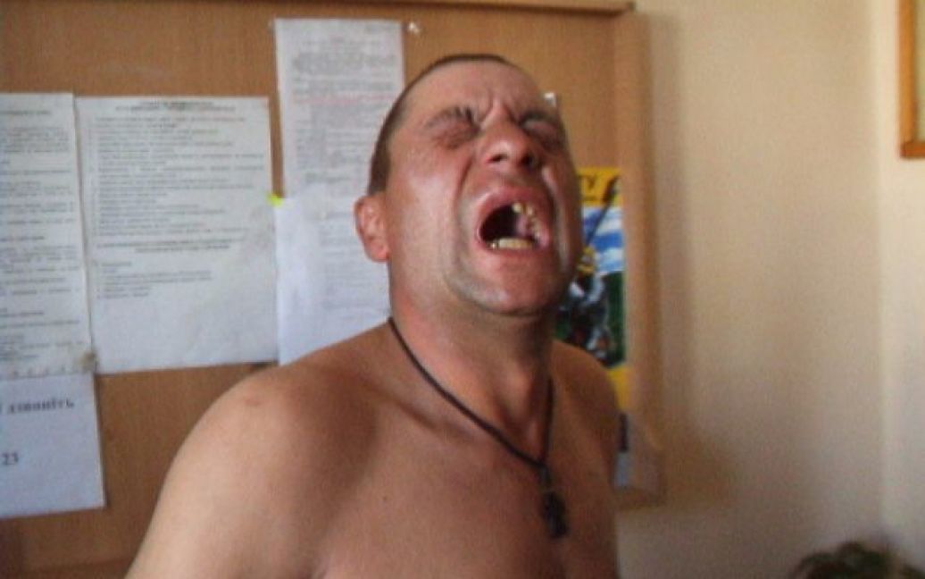Чернівецькі рибалки стверджують, що їх побили голова Чернівецької РДА Михайло Бойчук і його зять. / © БукІнфо