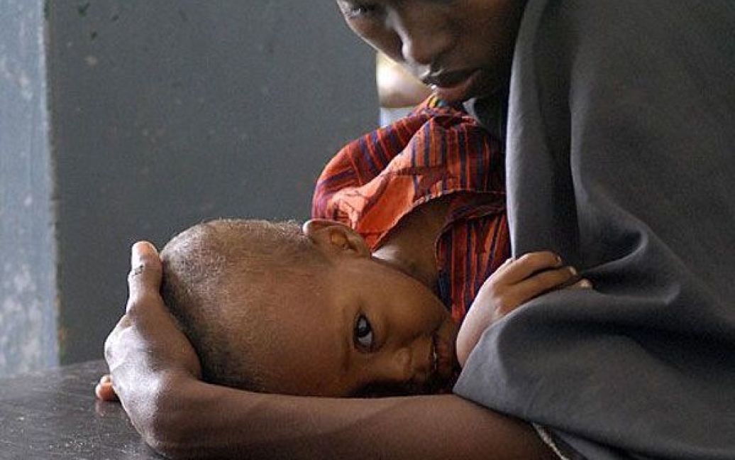 Сомалі, Могадішо. Переміщена всередині країни сомалійська мати тримає свою дитину, виснажену від голоду та посухи, у лікарні міста Могадішо. Смертність серед постраждалих від посухи сомалійців у таборах біженців зросла в кілька разів. / © AFP