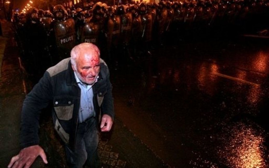 Грузія, Тбілісі. Поранений чоловік проходить повз кордон грузинської поліції, які розганяють мітинг опозиції перед парламентом у Тбілісі. П&#039;ятиденна акція протесту опозиції з вимогою відставки президента Михайла Саакашвілі закінчилася трагічно. / © AFP
