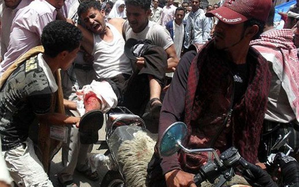 Ємен, Таїз. Єменських антиурядових демонстрантів, які постраждали під час сутичок з поліцією на акції протесту, евакуюють до лікарні. Сили безпеки застосували сльозогінний газ і вогнепальну зброю для розгону демонстрації, убивши трьох і поранивши десятки демонстрантів. / © AFP