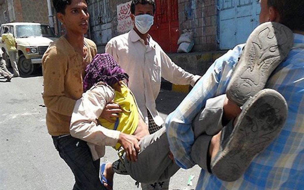 Ємен, Таїз. Єменський демонстрант постраждав під час зіткнень між маніфестантами, які вимагають повалення президента Ємену Алі Абдалли Салеха, і єменськими силами безпеки. Поліція застрелила 15 антиурядових демонстрантів і поранила десятки. / © AFP