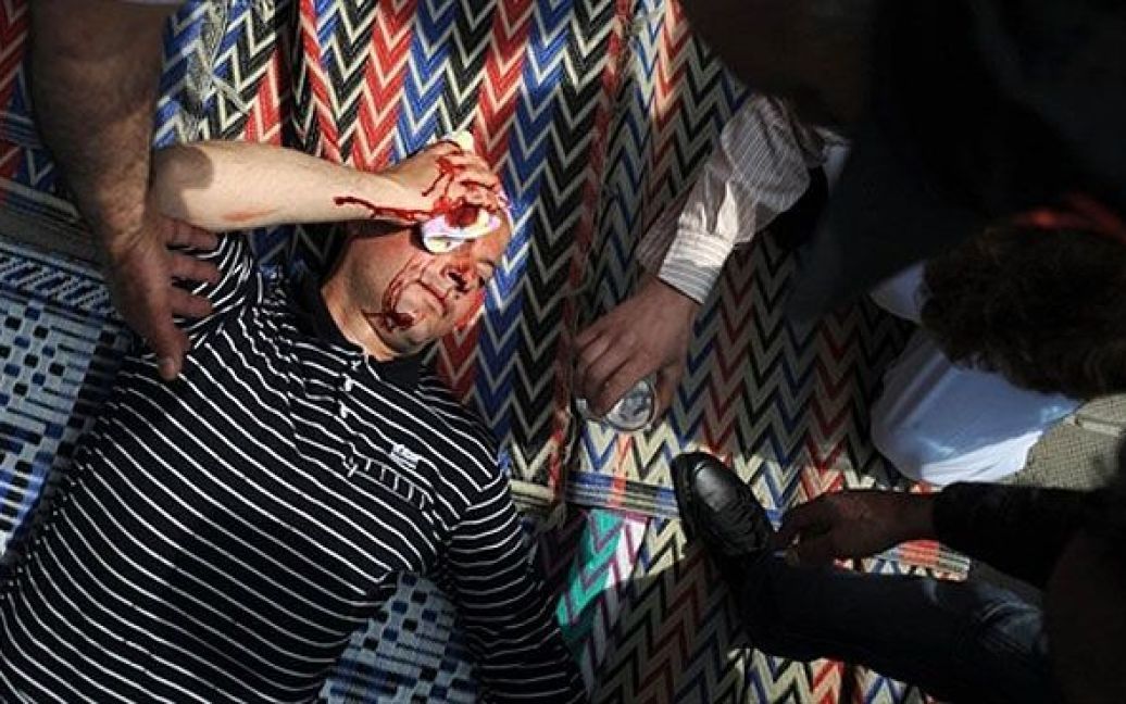 Болгарія, Софія. Мусульманин із закривавленою головою лежить на землі після поранення під час бійки між мусульманами та болгарськими крайніми націоналістами перед мечеттю в Софії. / © AFP