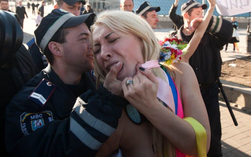 Після затримання міліцією одна з активісток руху FEMEN Інна Шевченко була госпіталізована з підозрою на перелом ключиці. / © femen.livejournal.com