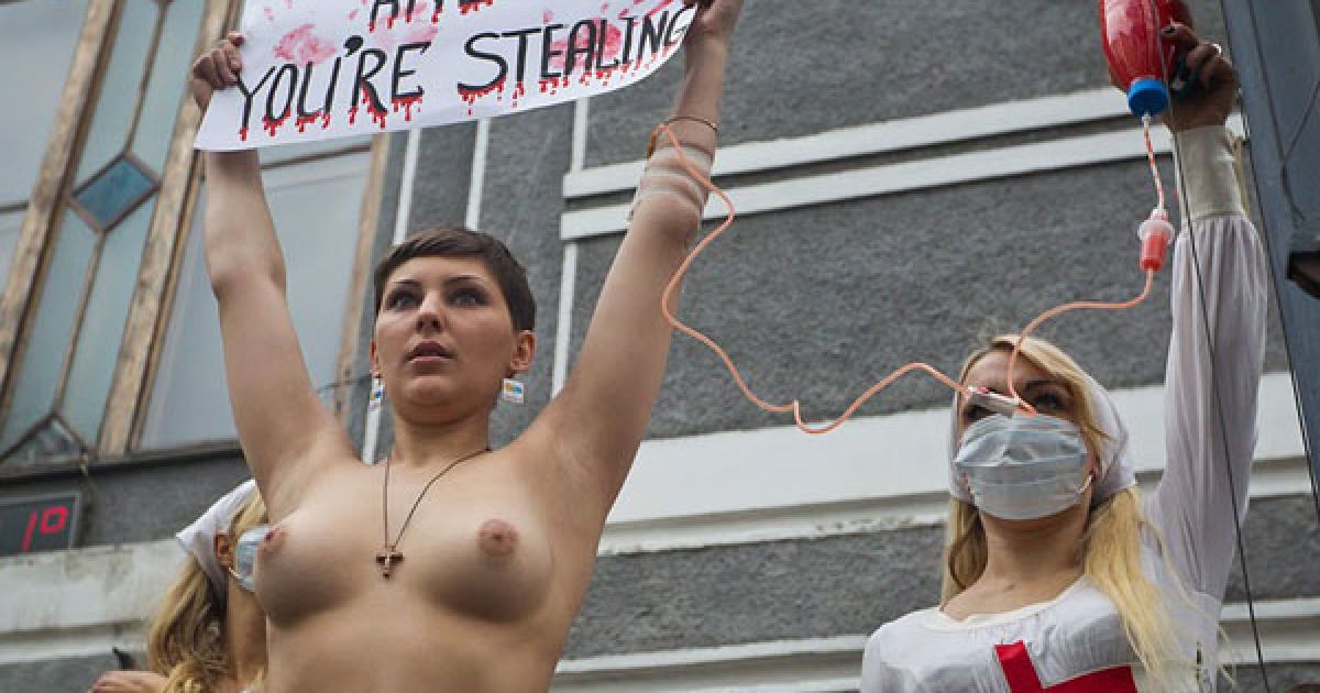 Активістка руху Аліна Ковальчук, яка страждає на рак лімфовузлів другої стадії протестувала топлес / © Жіночий рух FEMEN