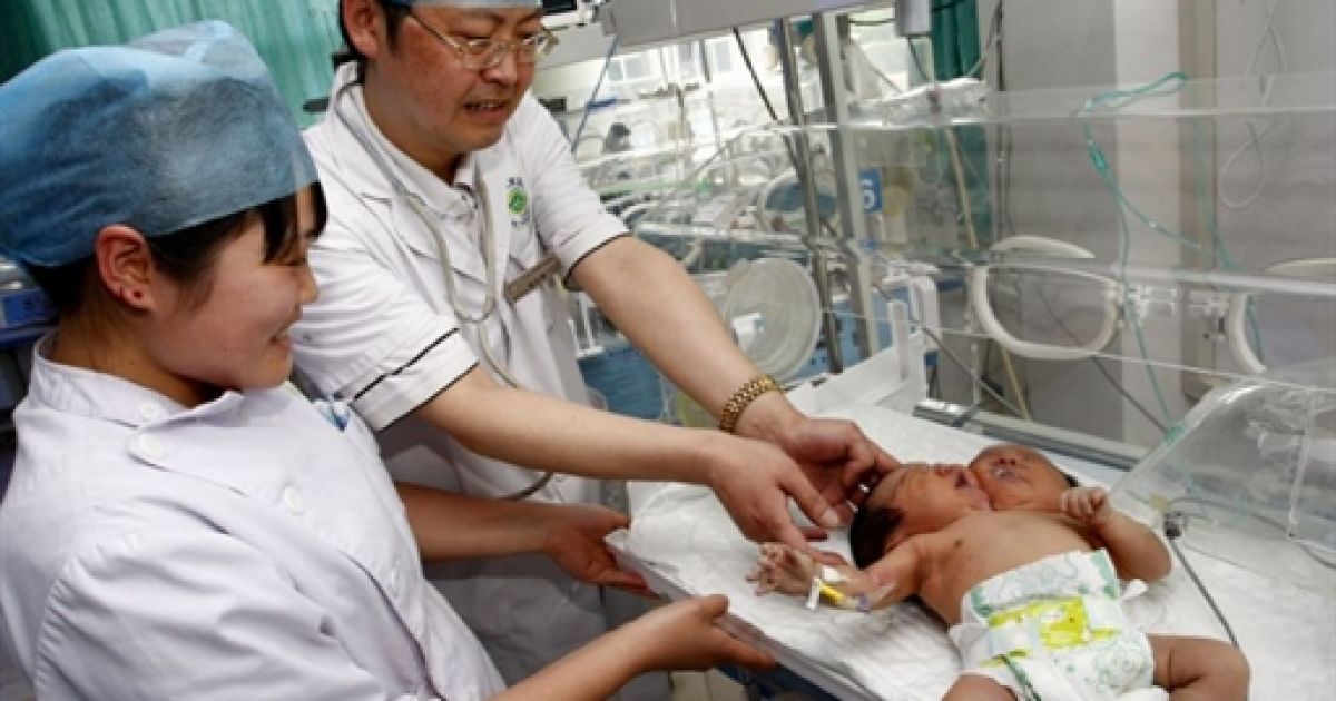 Незвичайні сіамські близнюки народилися у молодої китаянки: у дівчат дві голови, але спільні внутрішні органи. / © AFP