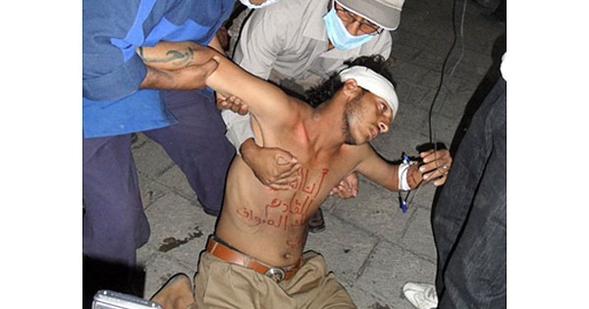 Ємен, Сана. Медики і добровольці допомагають пораненому у зіткненнях між демонстрантами і владою під час акції протесту у Сані. Двоє демонстрантів загинули, кілька сотень отримали поранення під час мітингу за повалення президента країни Алі Абдалли Салеха. / © AFP