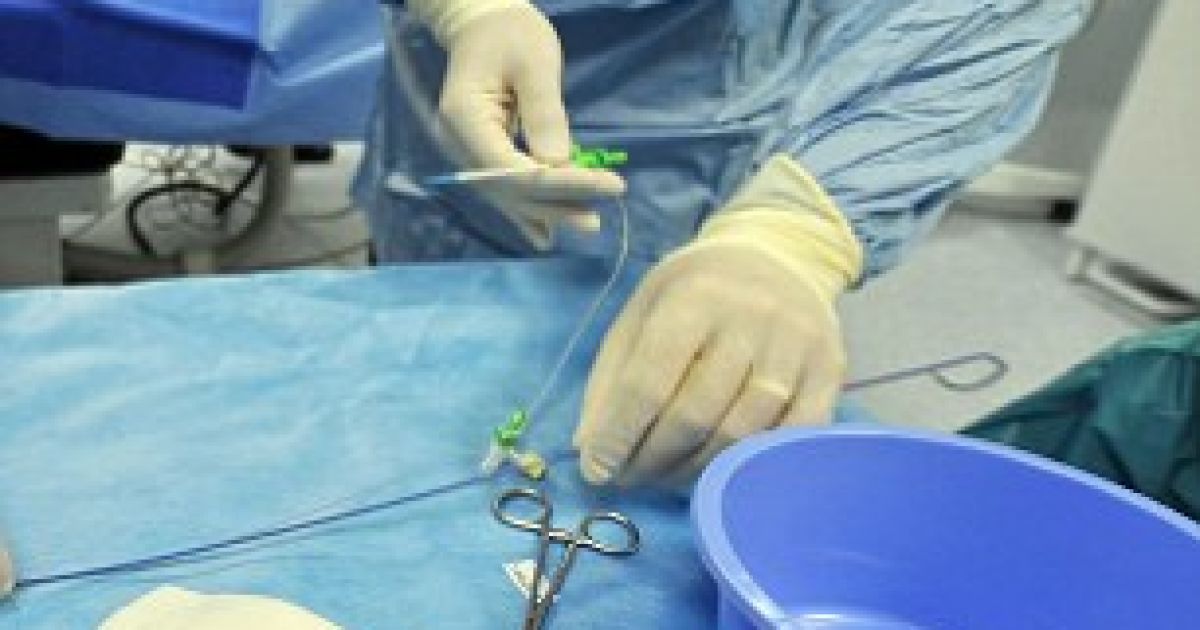 41-річний ірландець Чарльз Макміллан був визнаний найкращим фотографом Ірландії після того, як у вересні 2010 року він зняв, як лікарі проводять операцію на його серці. / © swns.com