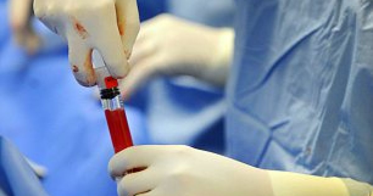 Для того щоб мати можливість працювати, Чарльзу довелося відмовитися від загального наркозу. / © swns.com