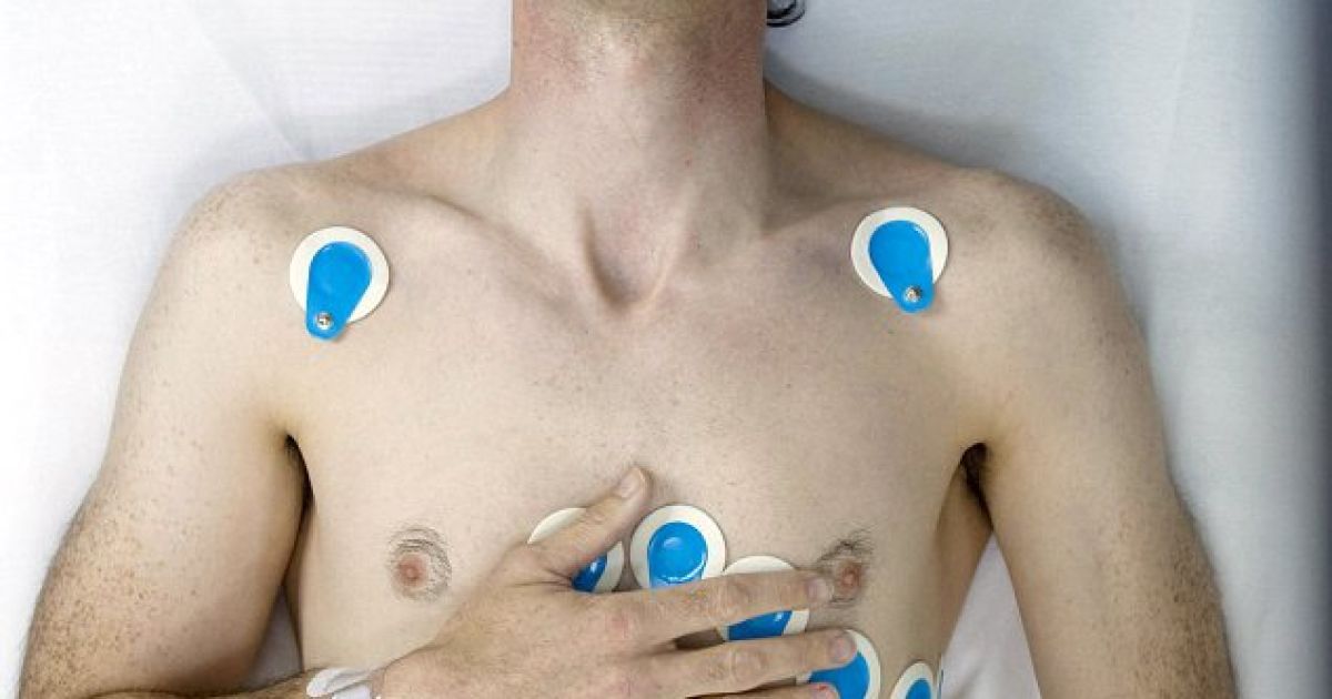 Між камерами фотограф перемикався за допомогою пульта дистанційного керування, а третю камеру він тримав над своєю головою протягом півтори години, поки тривало стентування. / © swns.com