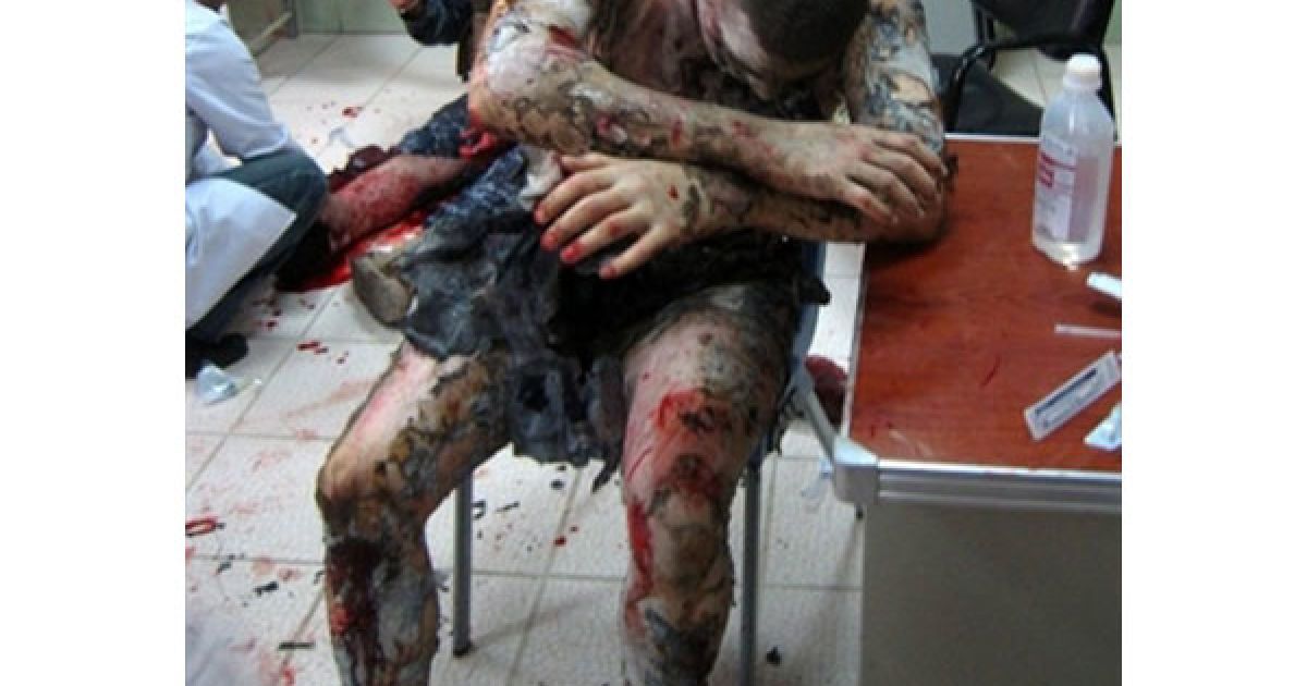Ірак, Кіркуку. Постраждалий іракський поліцейський чекає на лікаря після того, як він отримав поранення під час вибуху бомби у північному місті Кіркук. В результаті трьох вибухів, загинули щонайменше 27 осіб, поранення дістали 89 осіб. / © AFP