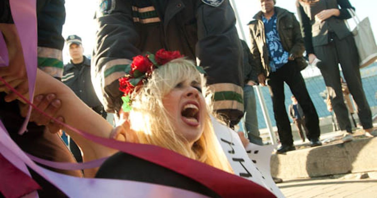 Після затримання міліцією одна з активісток руху FEMEN Інна Шевченко була госпіталізована з підозрою на перелом ключиці. / © femen.livejournal.com