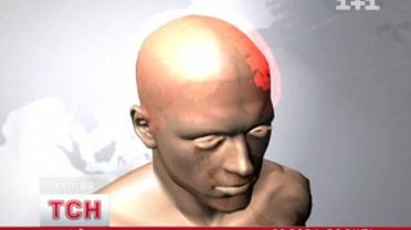 Изменение погоды и снова мигрени